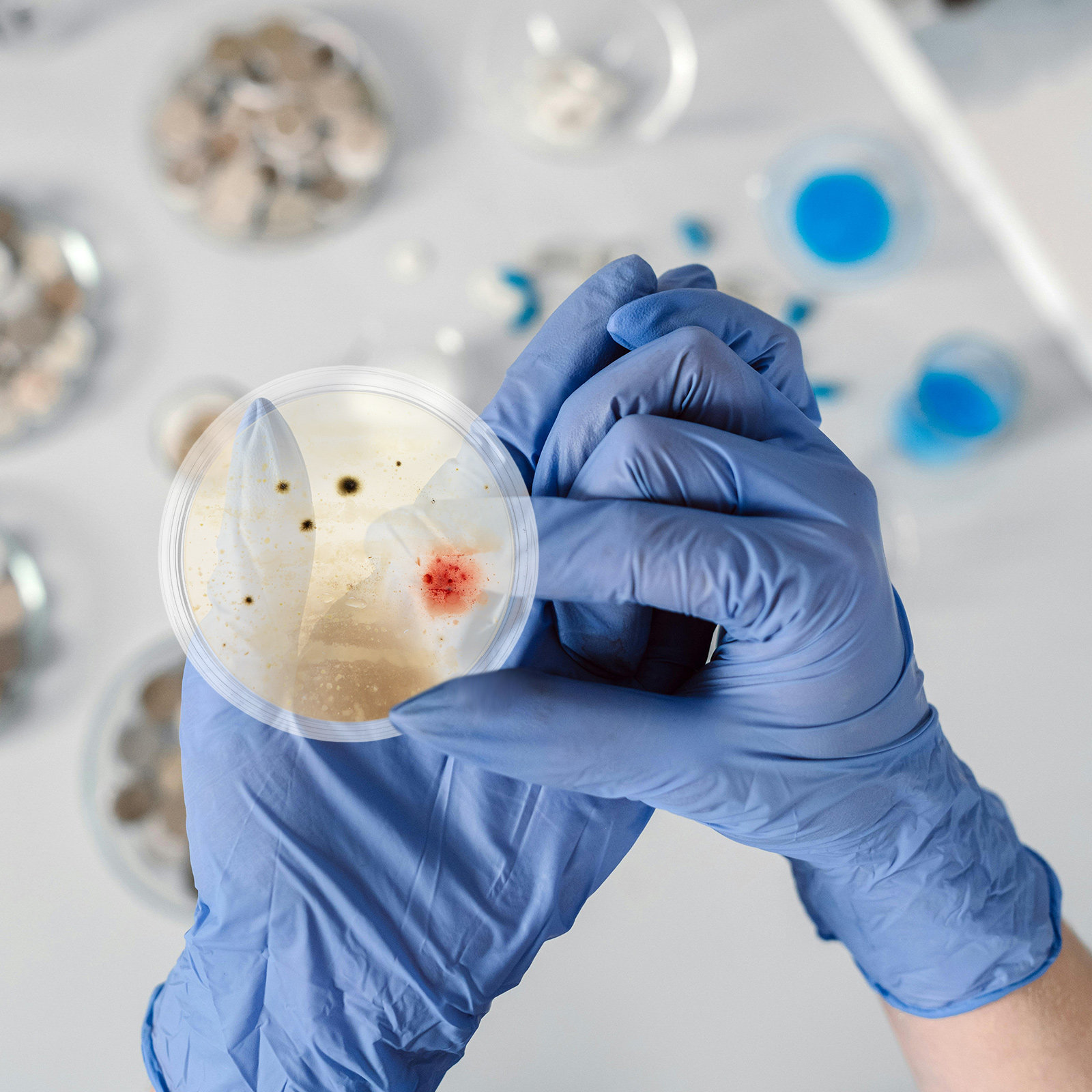 10 Pcs Agar Plates Tissue Cult - огляд і ціна Agar Tissue Culture